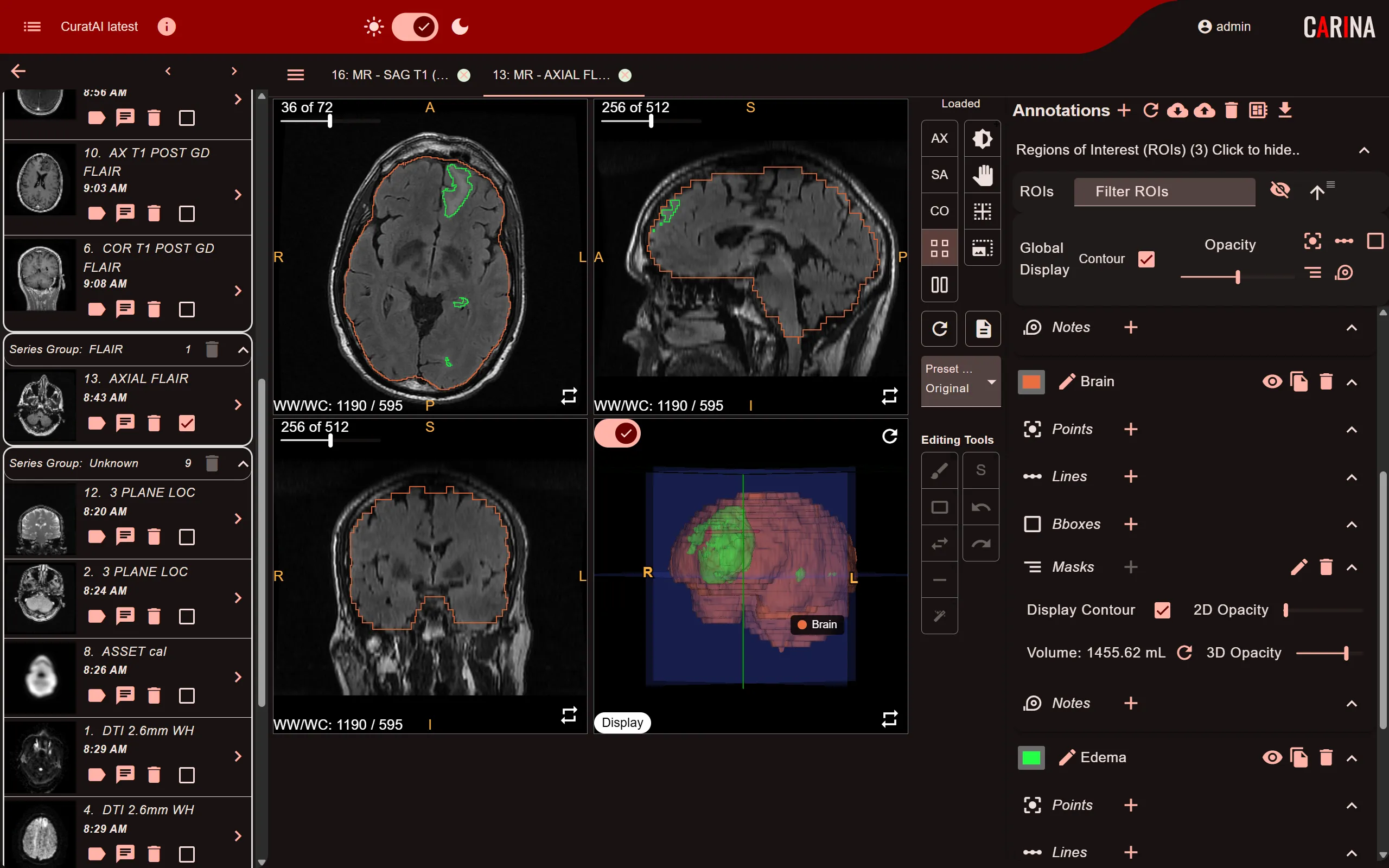 CuratAI annotation viewer with AI-assisted annotation and multi-user assignment