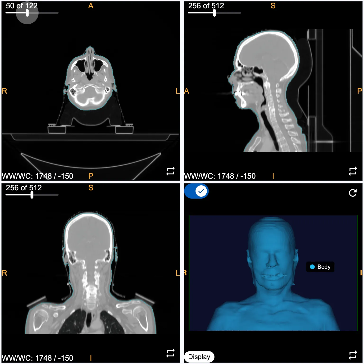 Original head CT — four-panel viewer