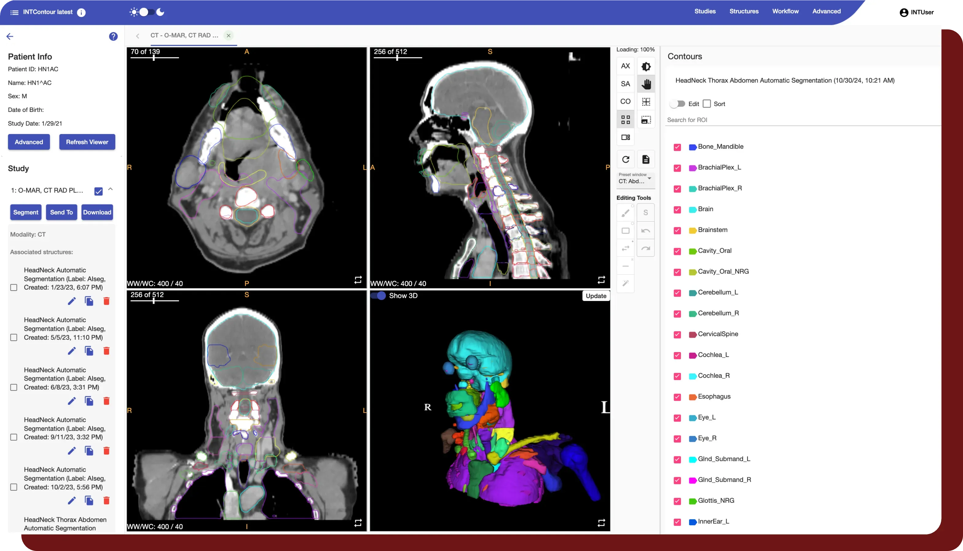 INTContour browser viewer with contour-refinement overlay on an axial CT slice