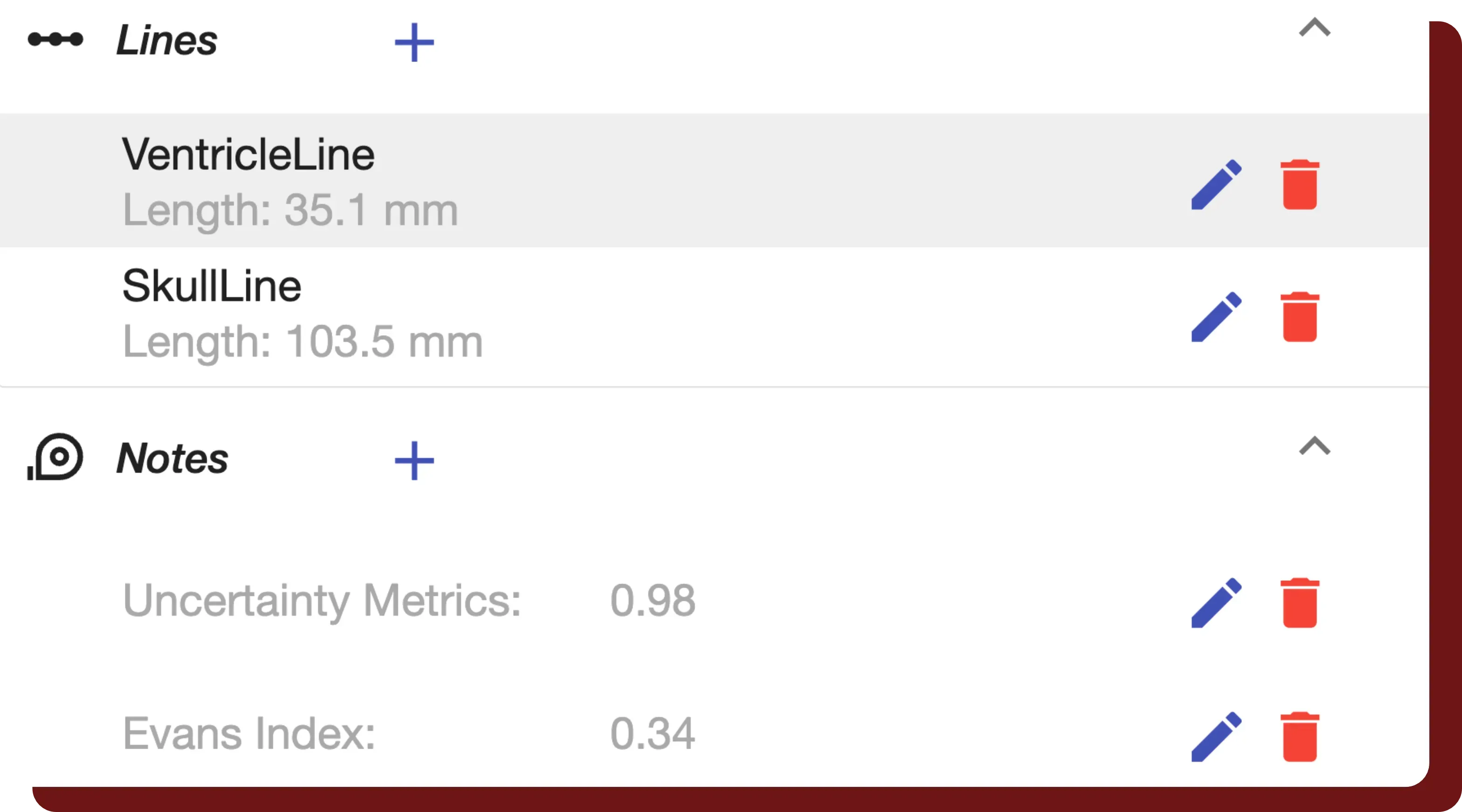 QuantBrain measurement panel — ventricle line, skull line, uncertainty metric, and computed Evans Index