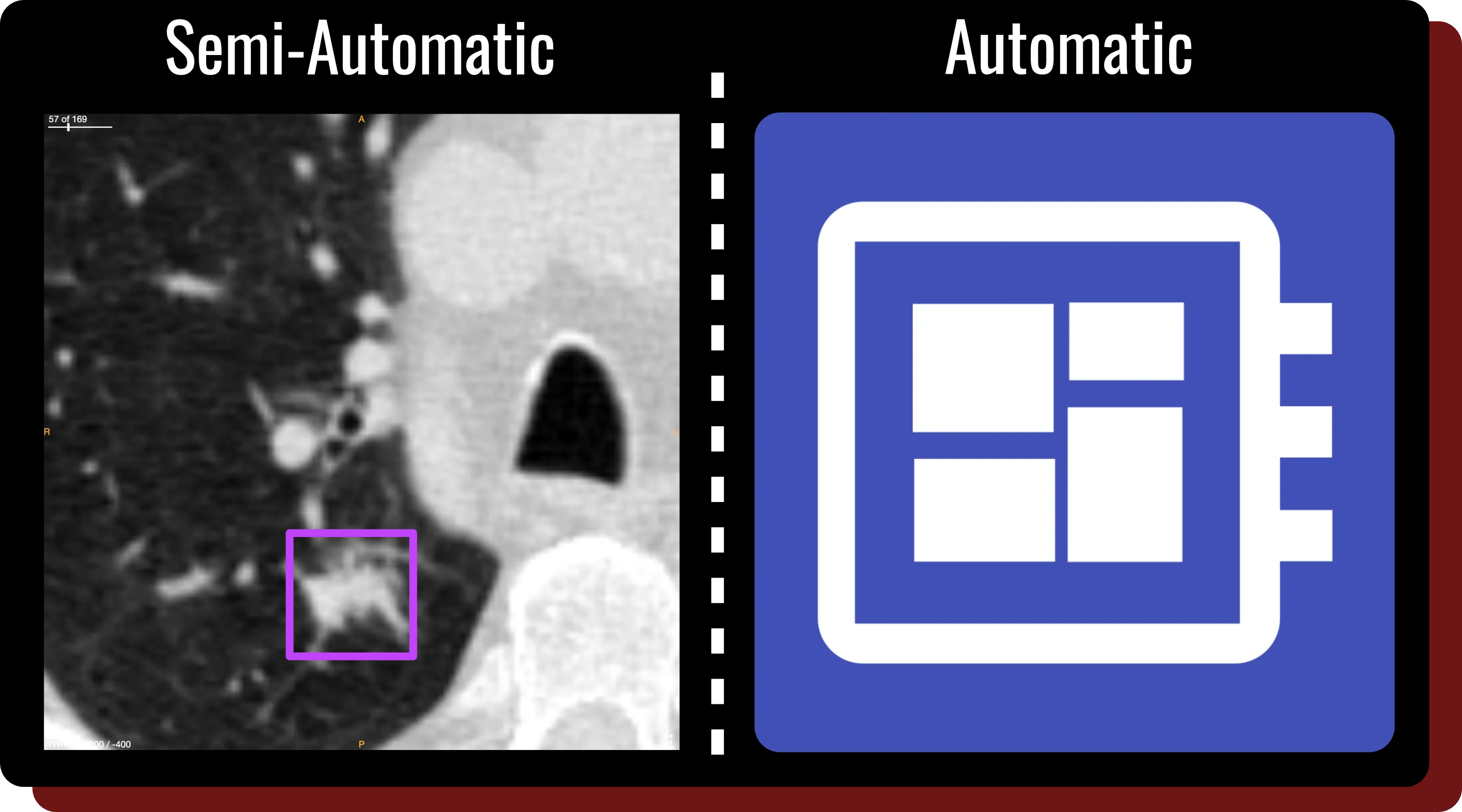 A figure illustrating the different options for segmentation that are available in OncoAI - LungNodule: semi-automatic and automatic segmentation. 