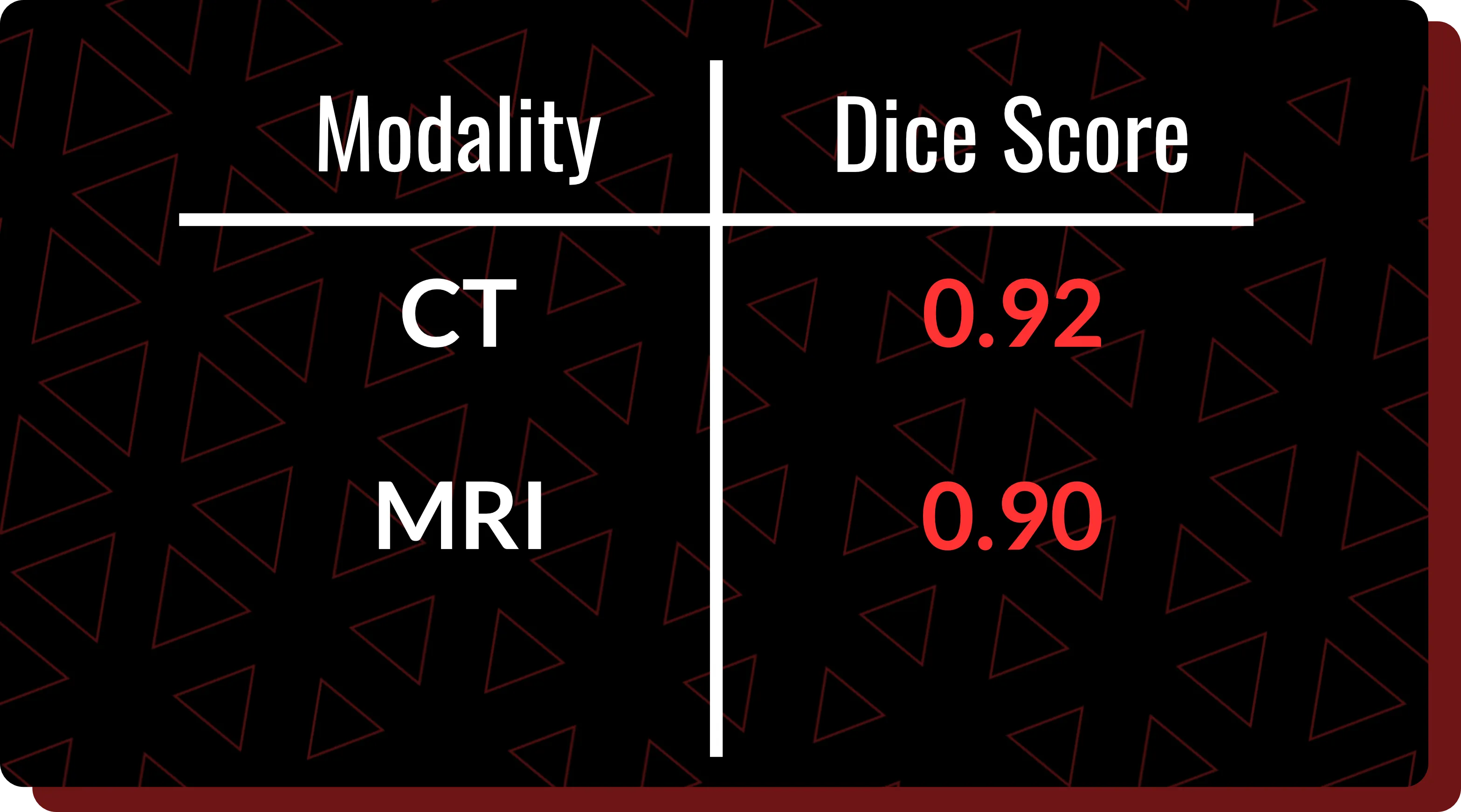 Dice Score values for QuantBrain - Ventricle segmentation modalities.