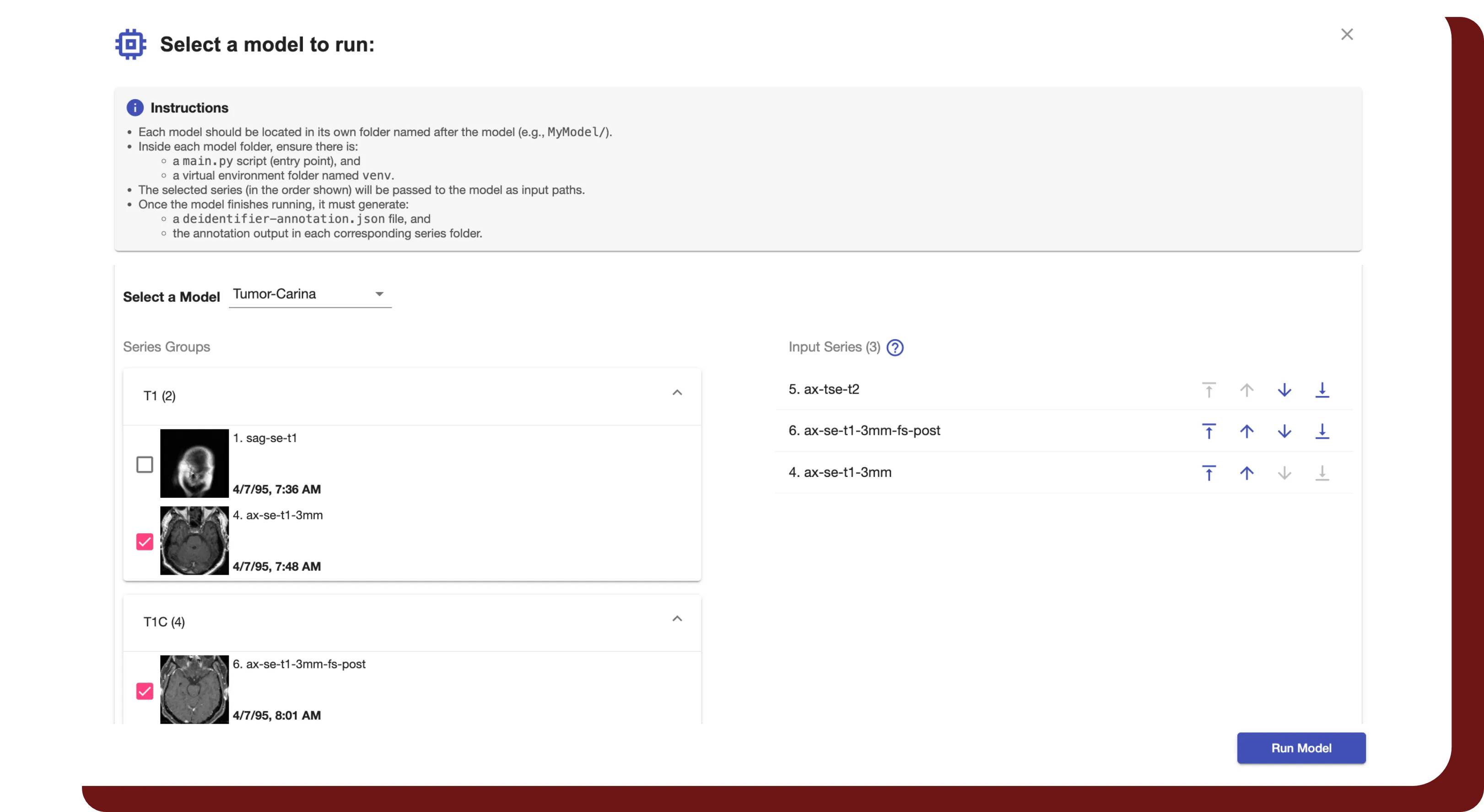 An image of DeIdentifier's user interface, showing how custom models can be added and run on medical series.