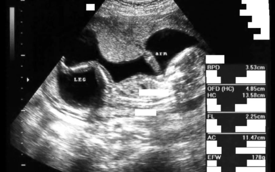 Original ultrasound and CT panels with burned-in text — PHI removed while measurements and modality markers are preserved