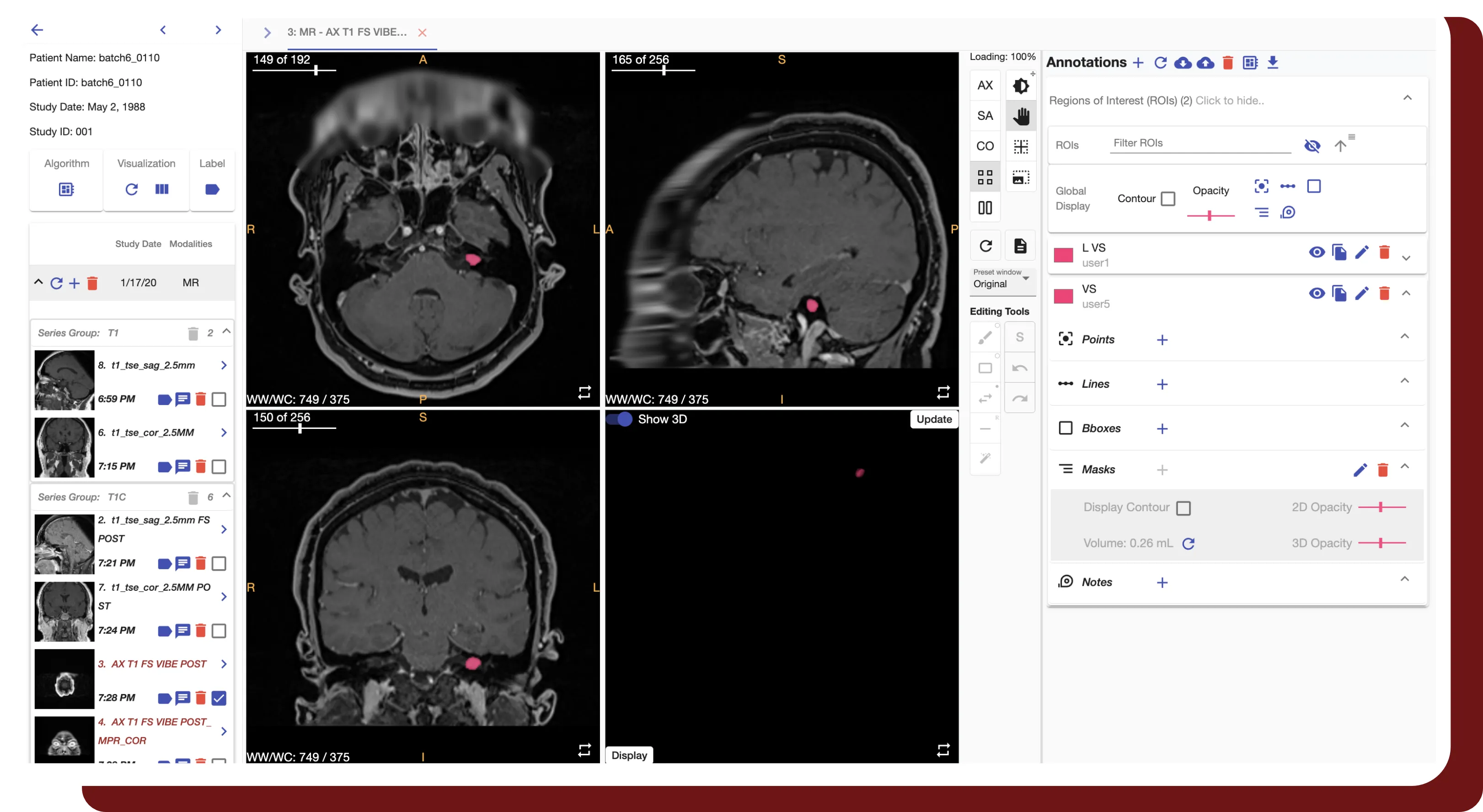 An example study shown in DeIdentifier's viewer panel.